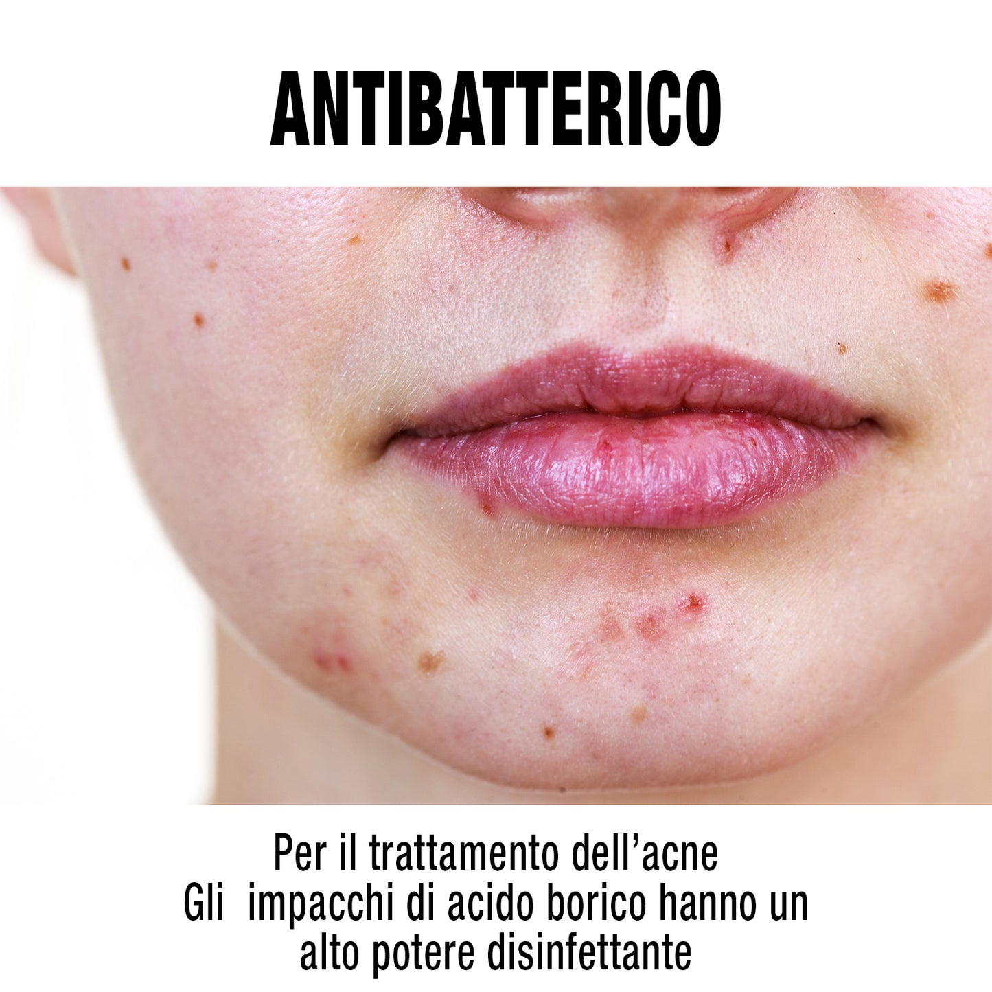 Acido Borico 500g